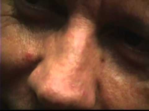 Ver video